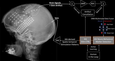 Explainable Artificial Intelligence for Neuroscience: Behavioral Neurostimulation